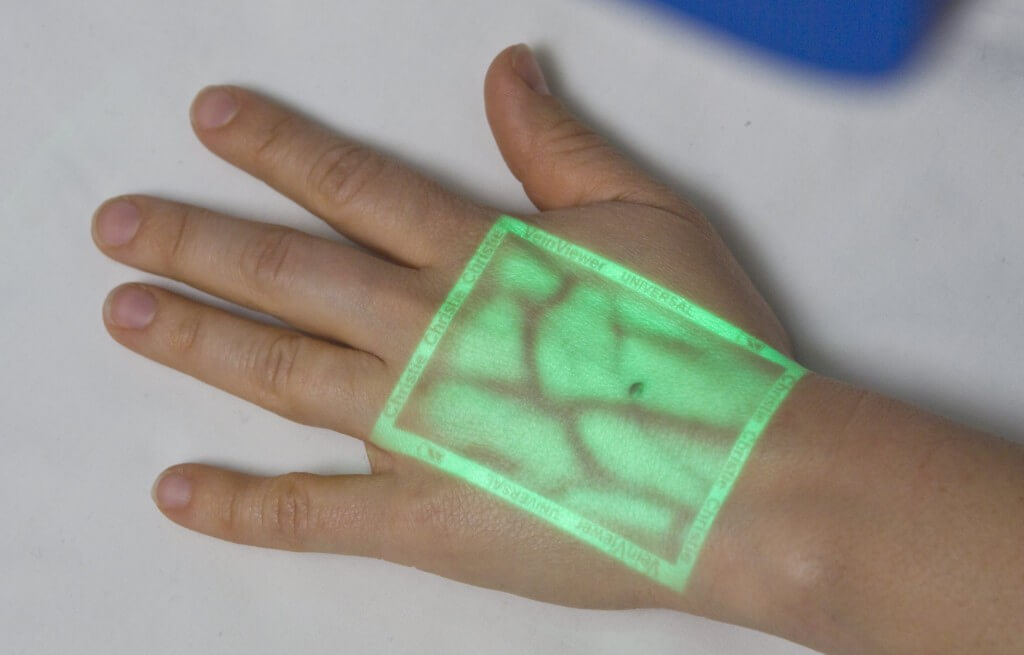 The Vision VeinViewer device